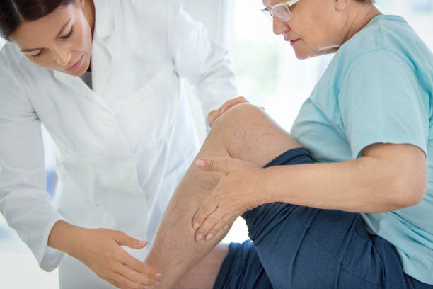 Senior woman in a massage treatment. Closeup side view of  female doctor massaging legs and calves of a senior female patient with visible varicose veins. leg stock pictures, royalty-free photos & images