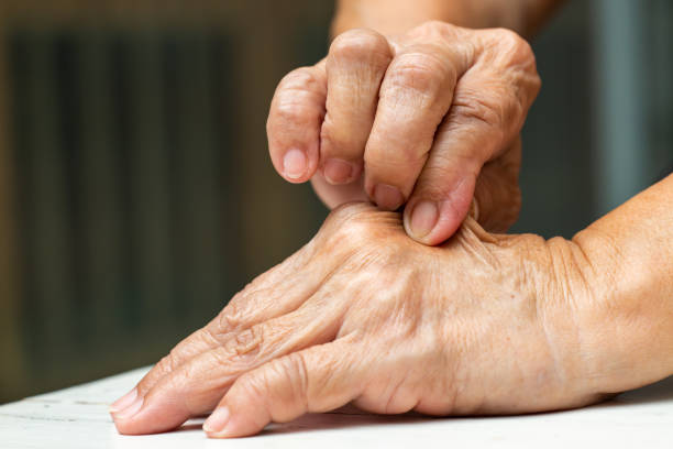 mano destra della donna anziana che pizzica la mano sinistra, su sfondo bianco del tavolo, primo piano, parte della pelle del corpo asiatico, concetto di assistenza sanitaria - pizzicotti foto e immagini stock
