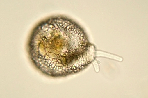 Some amoebas like this one form shells. Shell is composed of bits of rock (sand), diatom shells, and other debris. Fresh water. Live specimen. Wet mount, 40X objective, transmitted brightfield illumination.