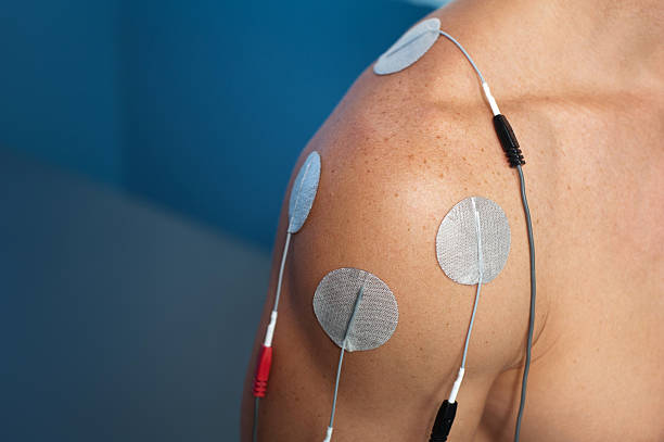 Shoulder Electrical Stimulation / TENS Physical therapy or chiropractic treatment of a male patient's injured shoulder using transcutaneous interferential electrical stimulation (TENS) for pain management. electrode stock pictures, royalty-free photos & images