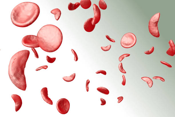 Sickle Cell Anemia 3D Illustration stock photo