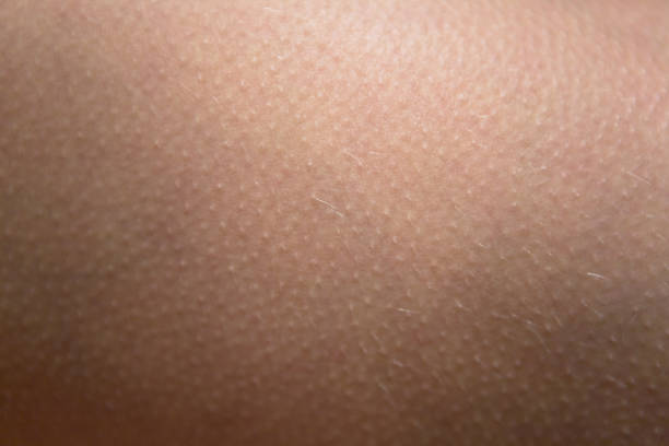 skin covered with goosebumps. stock photo