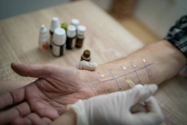 test alergii na ukłucie skóry - mitrovic zdjęcia i obrazy z banku zdjęć