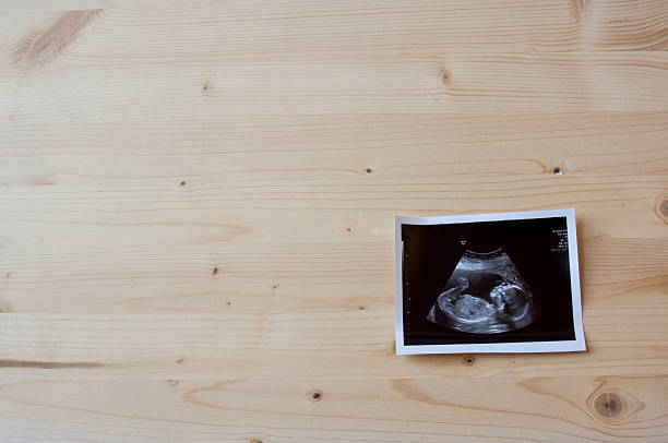 Sonogram on Wood Sonogram of a small baby on a wooden background. obstetrician photos stock pictures, royalty-free photos & images