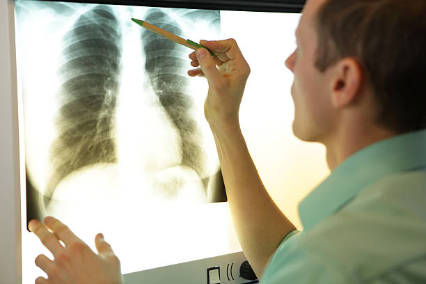 specialist watching image of chest at x-ray stock photo