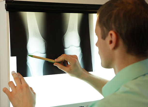 specialist watching x-ray image of knees and lower limbs specialist watching image of knees and lower limbs at x-ray film viewer x ray plates stock pictures, royalty-free photos & images