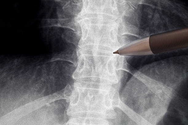 radiografía de la columna vertebral - cuello humano fotografías e imágenes de stock