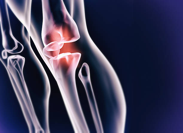 Sporting injury A cgi view of an inflamed joint isolated on blue cartilage stock pictures, royalty-free photos & images