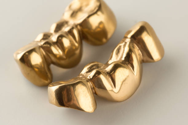 Steel artificial dental crown stock photo