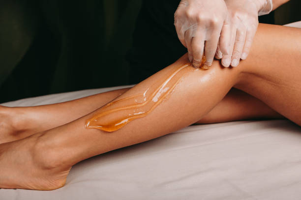 Sugaring epilation done in a spa salon by a young professional during a procedure stock photo
