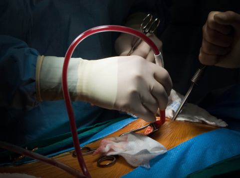pericardial surgery bluvet diventare chirurgico femmina