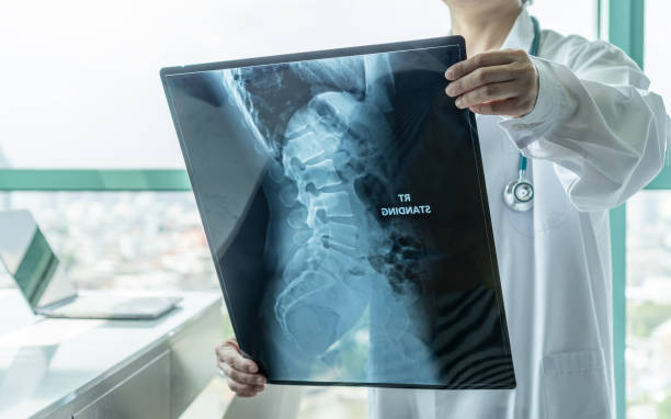 chirurgischer arzt mit blick auf radiologischen spinal-röntgenfilm für die medizinische diagnose der patientengesundheit auf wirbelsäulenerkrankungen, knochenkrebserkrankungen, spinale muskelatrophie, medizinisches gesundheitskonzept - muskulös stock-fotos und bilder