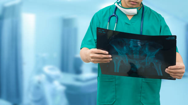 Surgical doctor looking at x-ray film. Surgical doctor examining xray film, diagnose patient 's waist bone. Surgery operation concept. orthopedics stock pictures, royalty-free photos & images