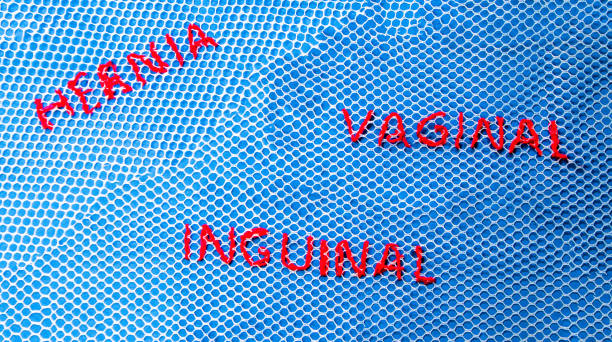 Surgical Mesh Surgical Mesh is seen as an International problem, being a very controversial way of repairing Hernias and Vaginal health issues. hernia inguinal stock pictures, royalty-free photos & images
