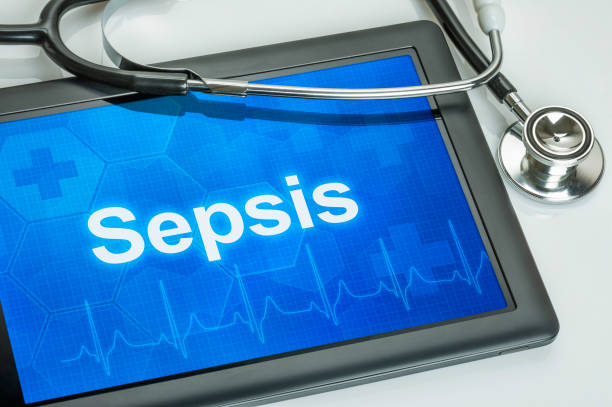 Tablet with the diagnosis Sepsis on the display stock photo