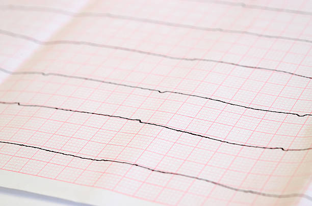 Tape ECG with ventricular asystole stock photo