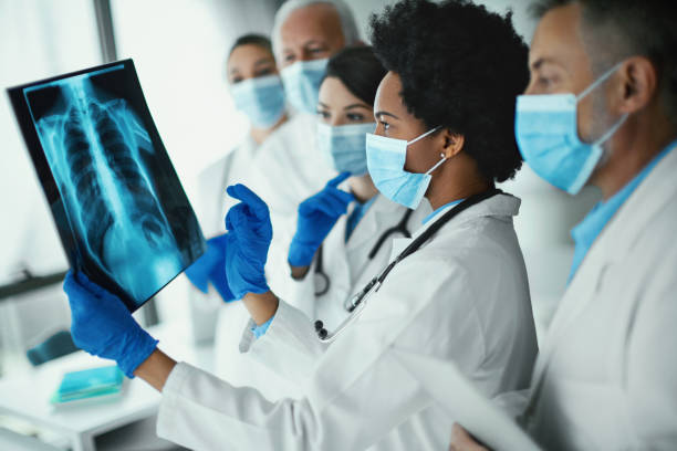Team of doctors analyzing an x-ray image of a COVID-19 patient. stock photo