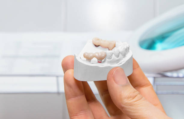 Technical shots of model on a dental prothetic laboratory stock photo