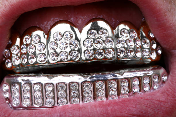 teeth-grill-bling-picture-id157198835