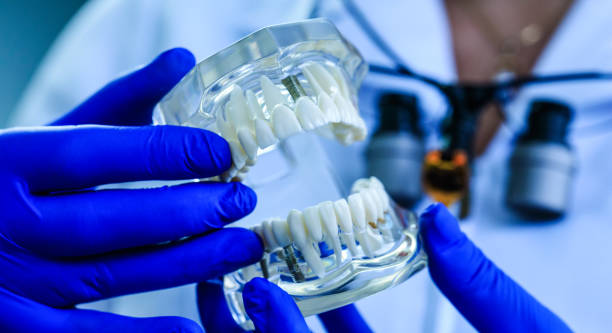Teeth model holding by real doctor in dentistry clinic. Tooth restoration. Oral care and orthodontic treatment on background of laboratory. stock photo