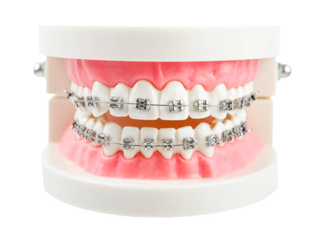 A flipper tooth is a temporary partial denture that is used to restore one or more missing teeth. Its purpose is to fill in any unsightly gaps so that you can smile and talk without feeling self-conscious. A flipper tooth is only used until a more permanent replacement can be fitted.   BENEFITS  Flipper Treatment is very inexpensive Fabricated prior to tooth extraction and fitted right after a natural tooth is removed Process requires fewer trips to your dentist compared to a more permanent partial denture Lightweight - Making them easier to wear and to tolerate   DISADVANTAGES  Not very strong or stable Fragile and easily broken Can be bulky, making them uncomfortable to wear, particularly towards the end of a long day When to choose a Flipper Tooth   This type of restoration is purely for temporary use, so it can be useful while you decide how to more permanently restore a missing tooth, or while waiting for dental implant treatment to be completed.  Do Nothing Those were the most popular ways to replace one or more missing teeth, but there is another option – doing nothing. However, this is not an advisable choice if you can help it. Jawbone density decreases after a natural tooth is removed due to the lack of stimulation that would normally be provided by a natural tooth root. If you later decide to replace the tooth with an implant, you’re more likely to need a bone graft to make up for the lost bone. Doing nothing will also allow any adjacent teeth to move out of position, potentially destabilizing them and affecting your bite. While it’s not always possible to replace missing teeth immediately after their loss (financially and/or physically), it is important to figure out a more permanent way of replacing them as soon as possible.