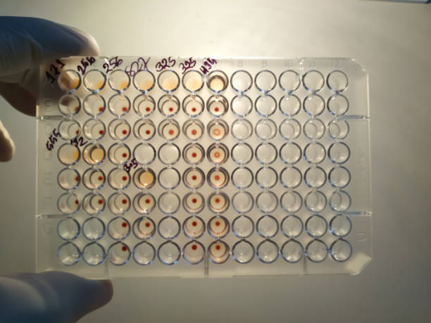 test plate for treponema pallidum haemagglutination (tpha) test. - price tag stockfoto's en -beelden