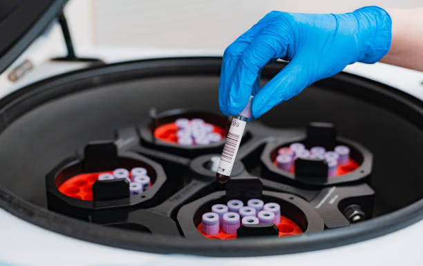 A test tube with blood tests is placed in a centrifuge with a hand in a blue rubber glove stock photo