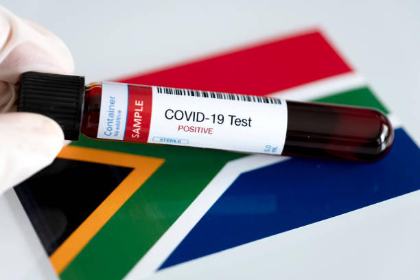 pruebas de presencia de coronavirus en sudáfrica - south africa covid fotografías e imágenes de stock