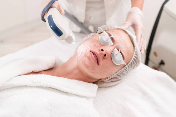 The doctor applies a special gel to the patient. Anti acne phototherapy with professional equipment. Beautiful woman during photo rejuvenation procedure. Face skin treatment at cosmetic clinic. stock photo