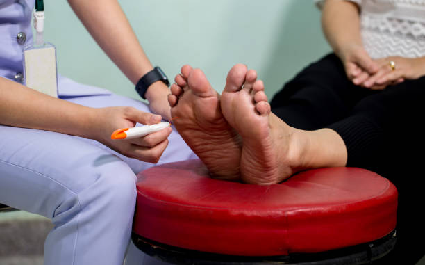The doctor examines the nerve response with monofilament odiatrist treating feet during procedure. The doctor examines the nerve response with monofilament odiatrist treating feet during procedure. Doctor neurologist examining female patient . foot exam diabetes stock pictures, royalty-free photos & images