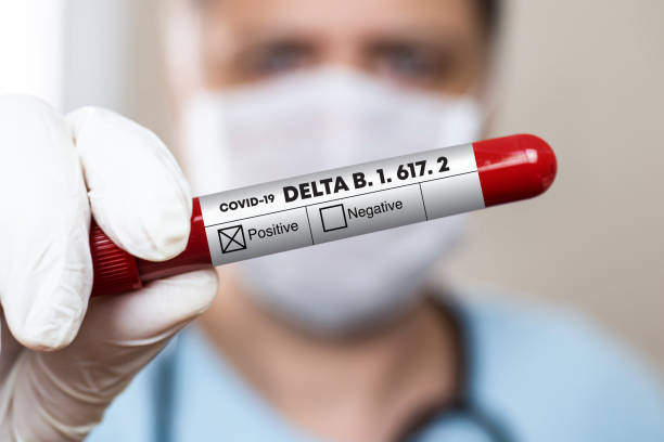 The doctor is holding a blood sample in his hand. Result Coronavirus Delta variant is positive. stock photo