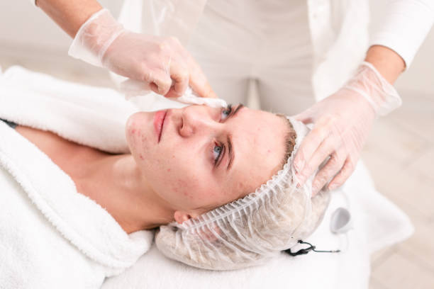 The doctor removes the gel from the patients face and apply a therapeutic cream. Anti acne phototherapy. Beautiful woman during photo rejuvenation procedure. Face skin treatment at cosmetic clinic. stock photo