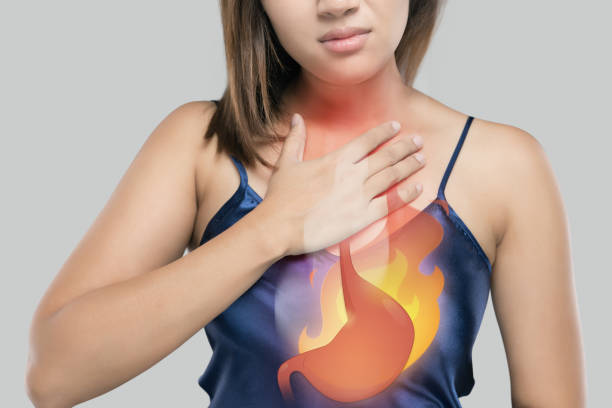 The Photo Of Cartoon Stomach On Woman's Body Against White Background, Acid Reflux Disease Symptoms Or Heartburn, Concept With Healthcare And Medicine stock photo