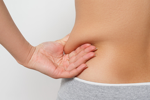 o que é abdominoplastia?