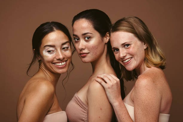 There is a kind of beauty in imperfection Young women having diverse skin problems standing together on brown background. Portrait of three young women with skin problems representing self acceptance and body positivity. imperfection stock pictures, royalty-free photos & images