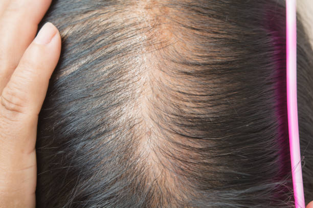 Oily Hair Stock Photos Pictures Royalty Free Images Istock