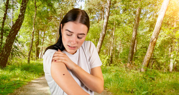 tick sits on a woman's arm in the forest a tick sits on a woman's arm in the forest lyme disease stock pictures, royalty-free photos & images