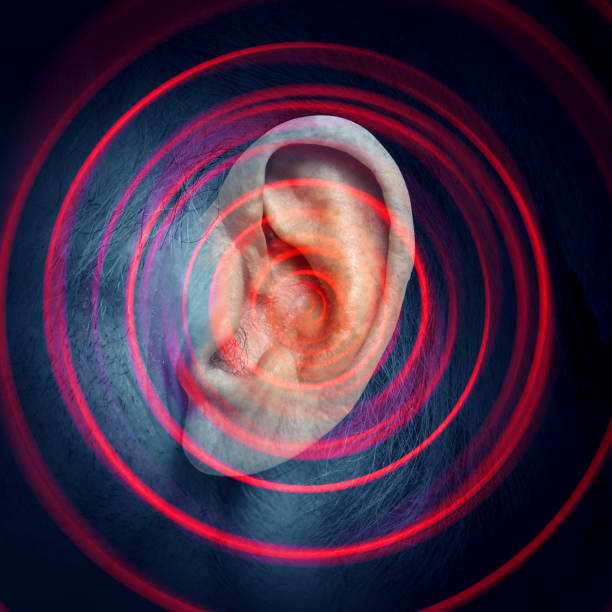 Tinnitus Disease Tinnitus disease as a ringing sound inthe inner ear as a hearing impairment and illness of the ears or painful infection in a 3D illustration style with an abstract radial blur. human ear stock pictures, royalty-free photos & images