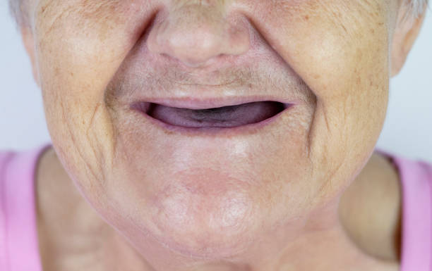 Toothless mouth. An elderly woman with no teeth. Old Granny with her mouth open. stock photo