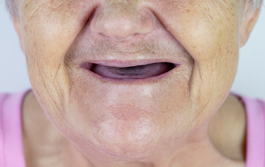 An elderly woman with no teeth. 