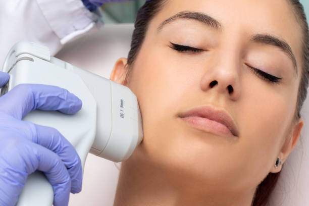 Top view of woman having facial hifu energy treatment. Top view of woman having cosmetic facial high intensity focal ultrasound treatment. beauty treatment stock pictures, royalty-free photos & images