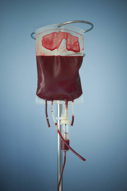 transfusion of blood, bag with red blood cells on stand. Blue background stock photo