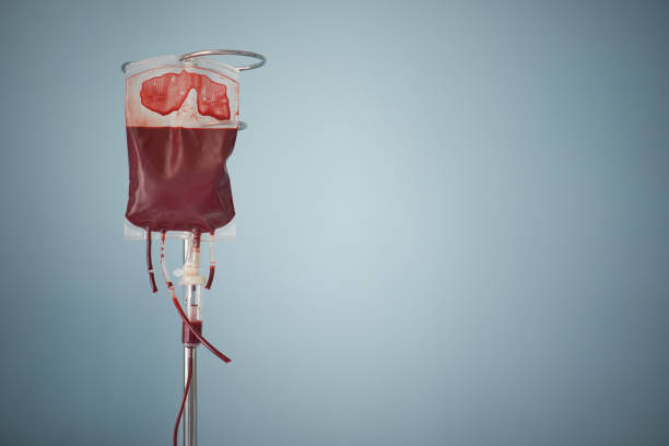 transfusion of blood, bag with red blood cells on stand stock photo