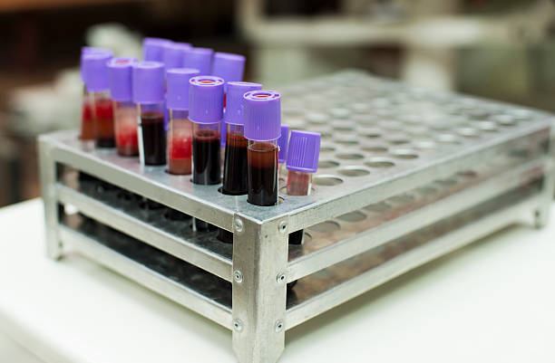 tubos de amostra no suporte de amostras - blood bar imagens e fotografias de stock