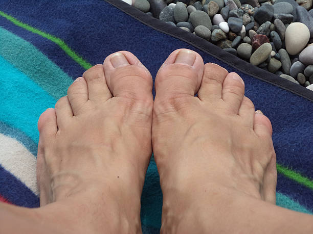 ugly-womens-feet-picture-id484730916