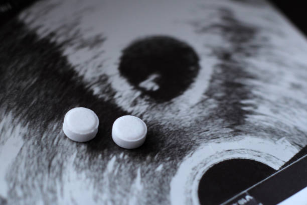 임신 한 여자와 약 약물의 초음파 - abortion 뉴스 사진 이미지