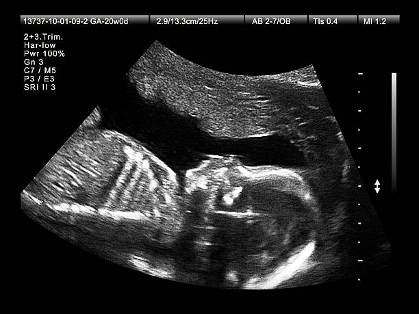 Ultrasound of fetus at 20 weeks during 2nd trimester stock photo
