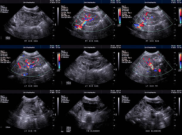 Ultrasound of Newborn Kidneys and Bladder stock photo