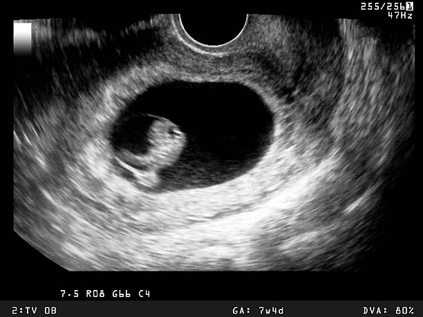 Ultrasound showing early stage of embryo development stock photo