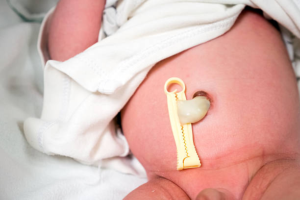 Umbilical cord of newborn baby stock photo